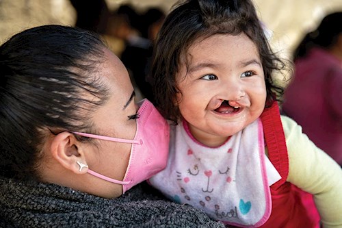 Impact 2021 - Surgeries Resume - Operation Smile Canada